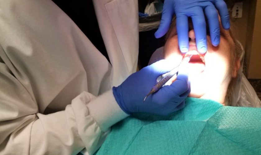Professional Teeth Cleaning - Benefits & Definition