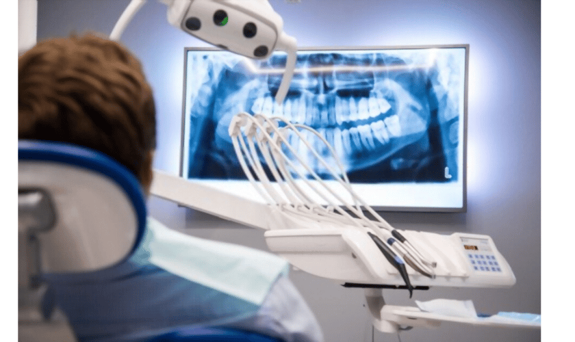 dental X Rays