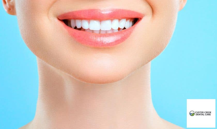 Tips-For-Teeth-Whitening