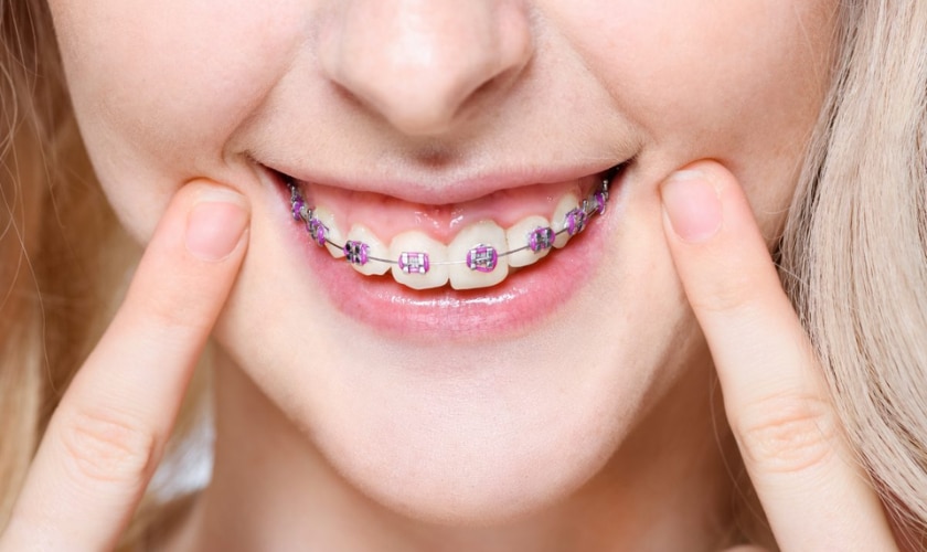 Orthodontics: Get A Perfect Smile With Braces & Invisalign.