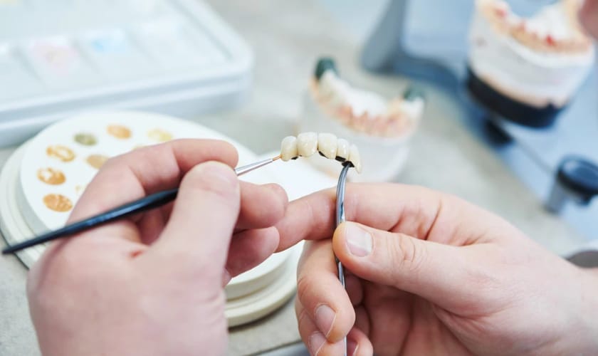 ow Porcelain Bridges Can Help You Achieve a Perfect Smile