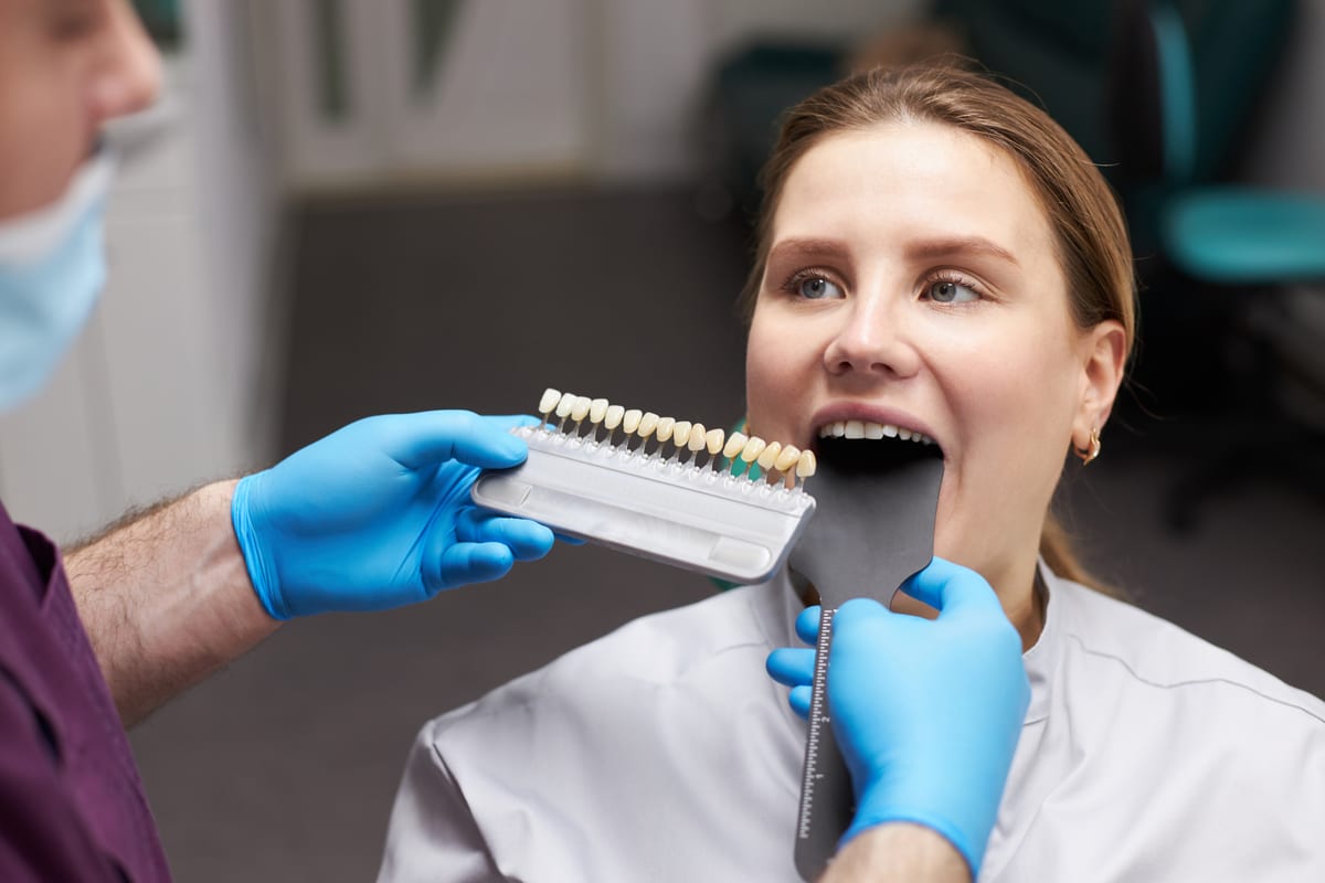 Why Modern Veneers Look More Natural Than Ever Before