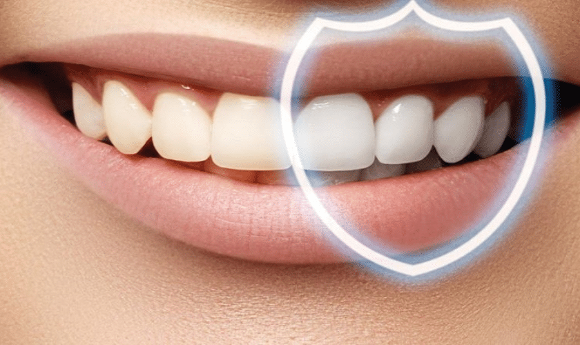 How To Maintain White Teeth After Whitening